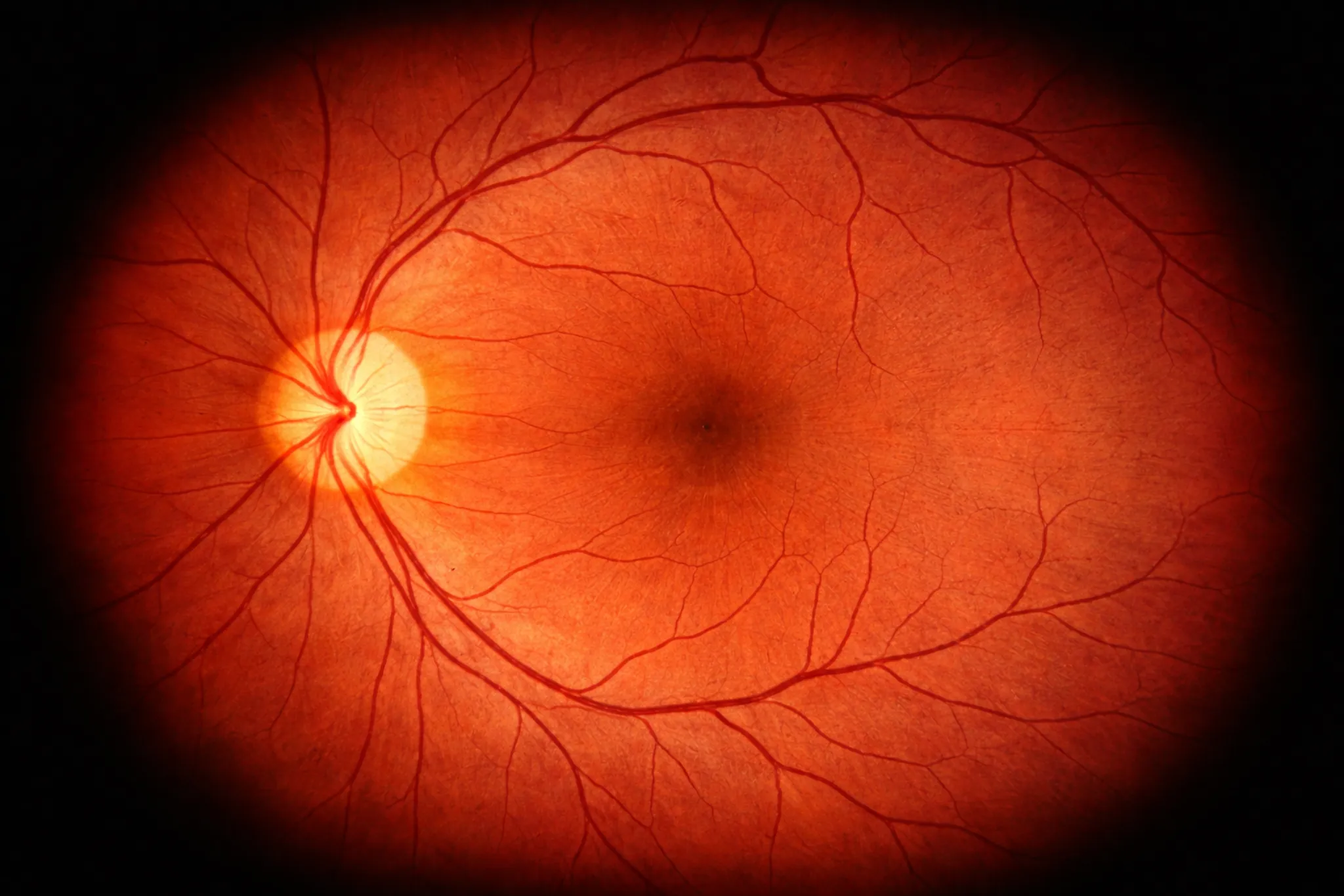 Retina Scan